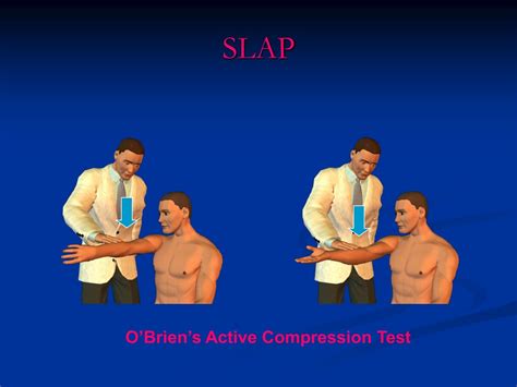 shoulder compression special tests|speed's test vs o'brien's.